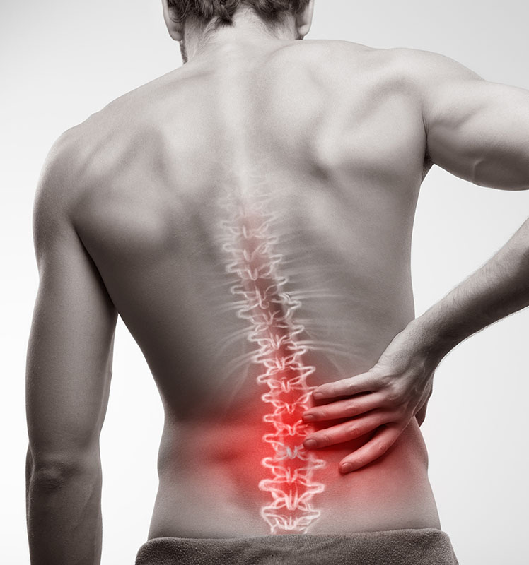patient of dr. keat ooi with spine disorders